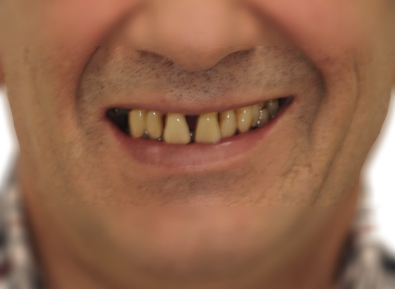 ortodoncia y periodoncia