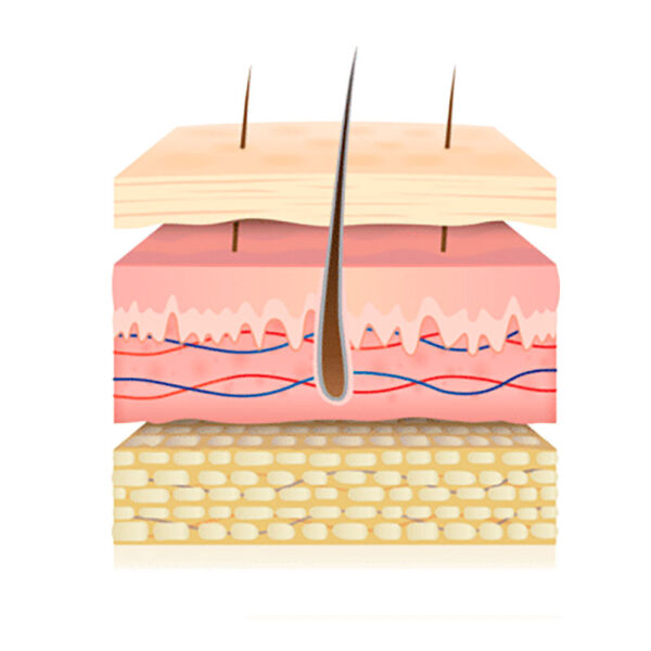 Microfillers: ¿Para qué sirve el Ácido Hialurónico? 