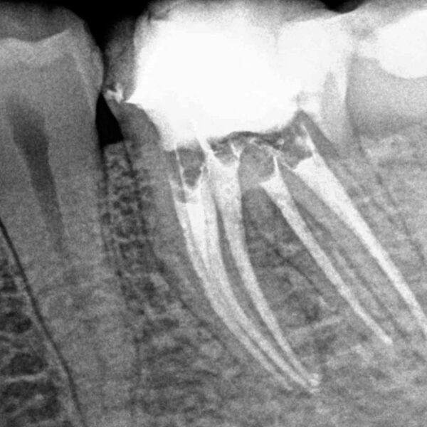 Endodoncia Exclusiva