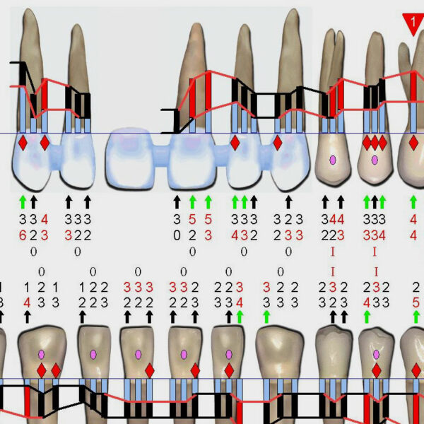 Periodontograma